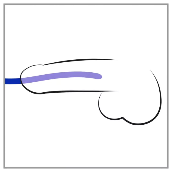 You2Toys - dilatointisetti - silikoninen, 3 kpl