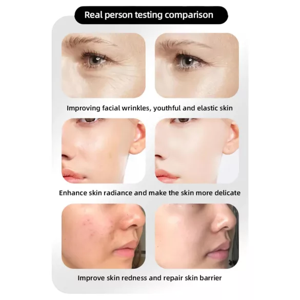 Photon Rejuvenation kasvojen LED-naamio